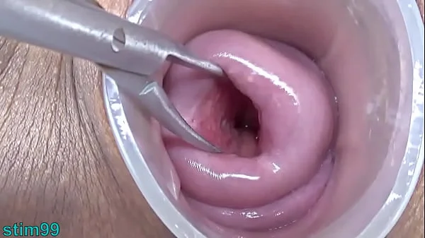 Japanese Wife Open Cervix Wide to watch inside Uterus