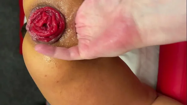 Hard Fisting And Prolapse From A Hot Bitch Monika Fox